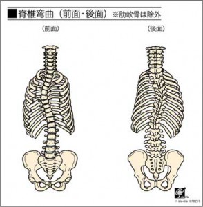 骨盤や脊柱の歪みが腸にも影響を及ぼす